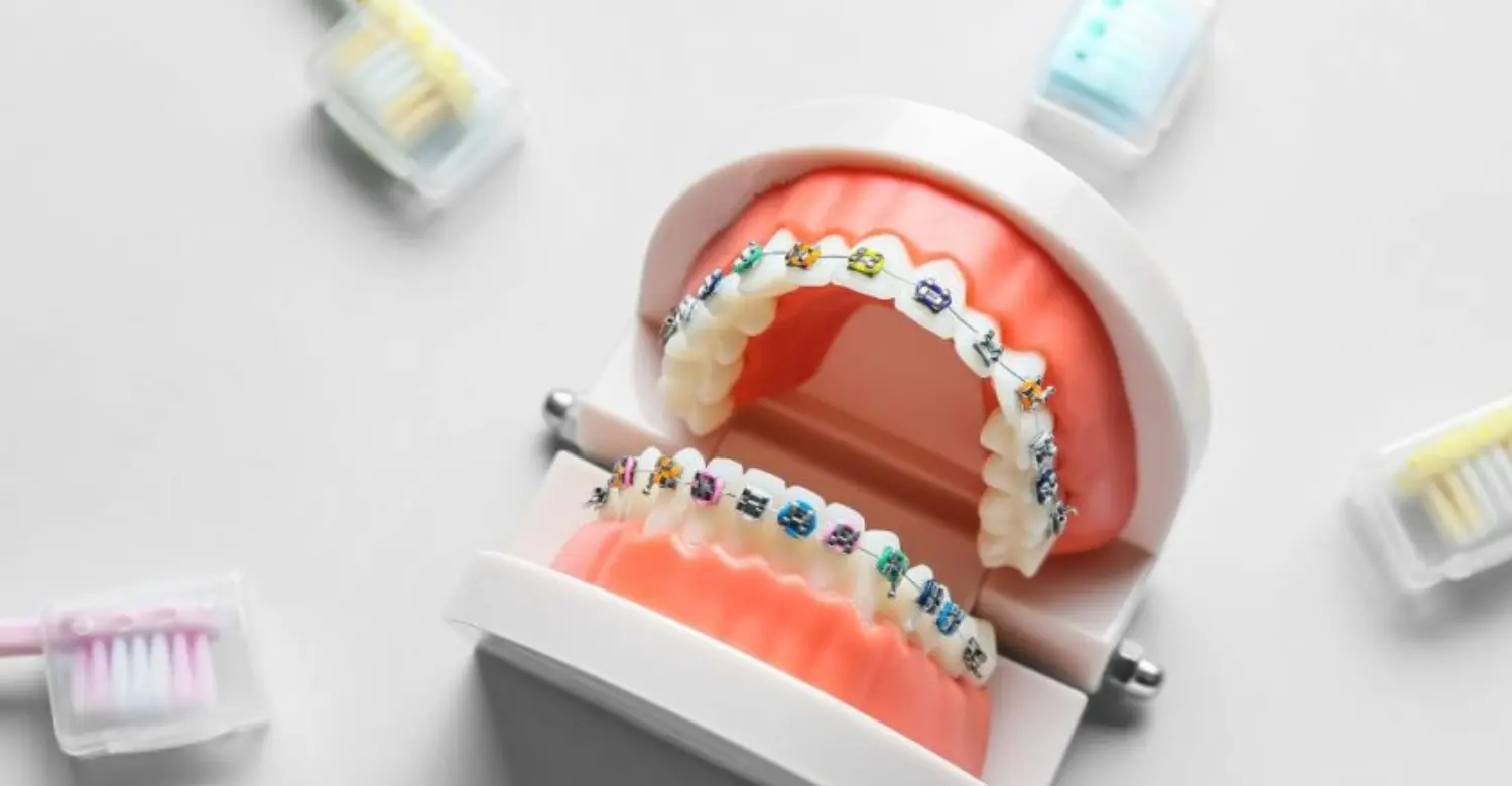 Is Orthodontic Treatment Necessary